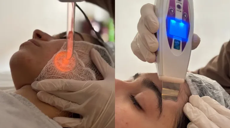 Alquimia da Pele: Uma Transformação Visível Já na Primeira Sessão